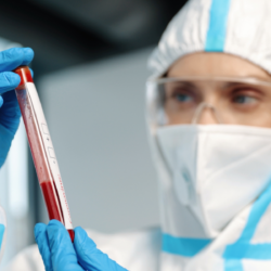 Key Challenging in Cell and Gene Therapy